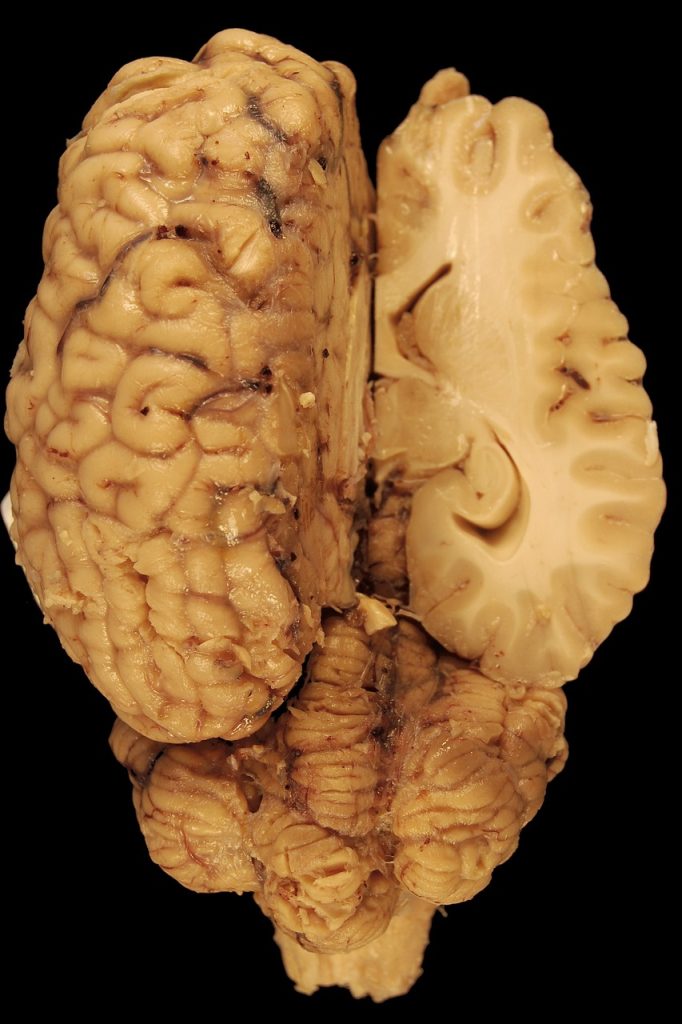 brain, nature, anatomy, horse, biology, dorsal, body, veterinary medicine, cerebrum, cerebellum, hemisphere, transversal cut, science, brain, brain, brain, brain, brain, cerebrum, cerebrum, cerebrum, cerebellum